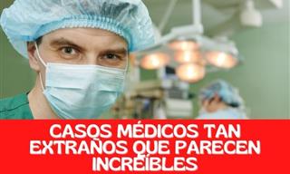 10 Casos Médicos Extraños a Los Que Se Han Enfrentado Los Doctores