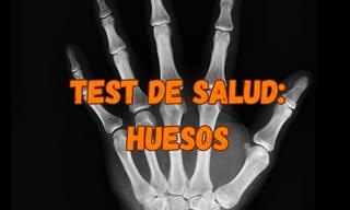 ¿Cuánto Sabes Sobre <b>Tus</b> Huesos?