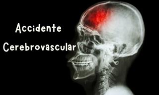 ¿Cuánto Sabes Sobre El Accidente Cerebrovascular?