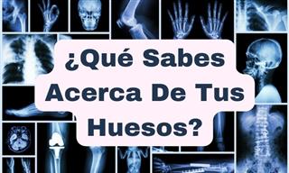 ¿Qué Sabes Acerca <b>De</b> <b>Tus</b> Huesos?